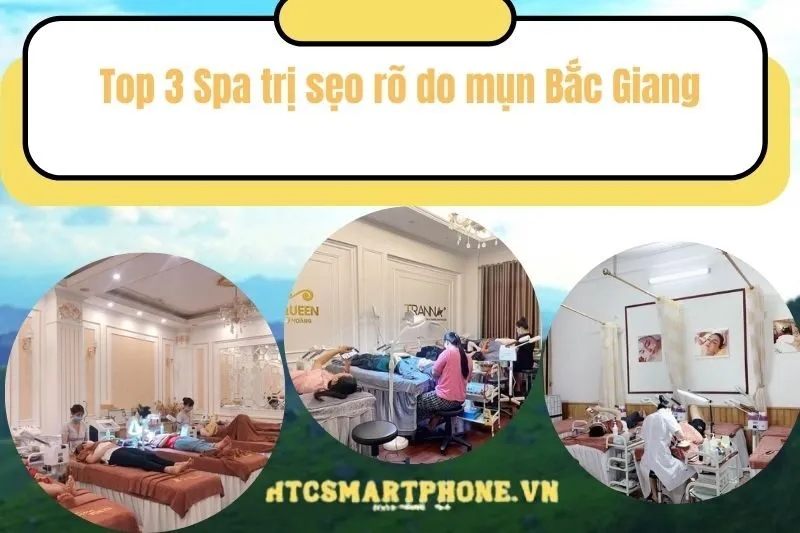 Top 3 Spa trị sẹo rõ do mụn Bắc Giang